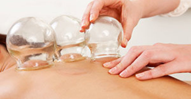 Cupping